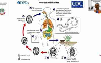 Worm Infestations and Deworming